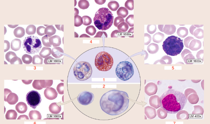 Diagram identify drag labels onto endocytosis types label pinocytosis phagocytosis transcribed text show vesicle